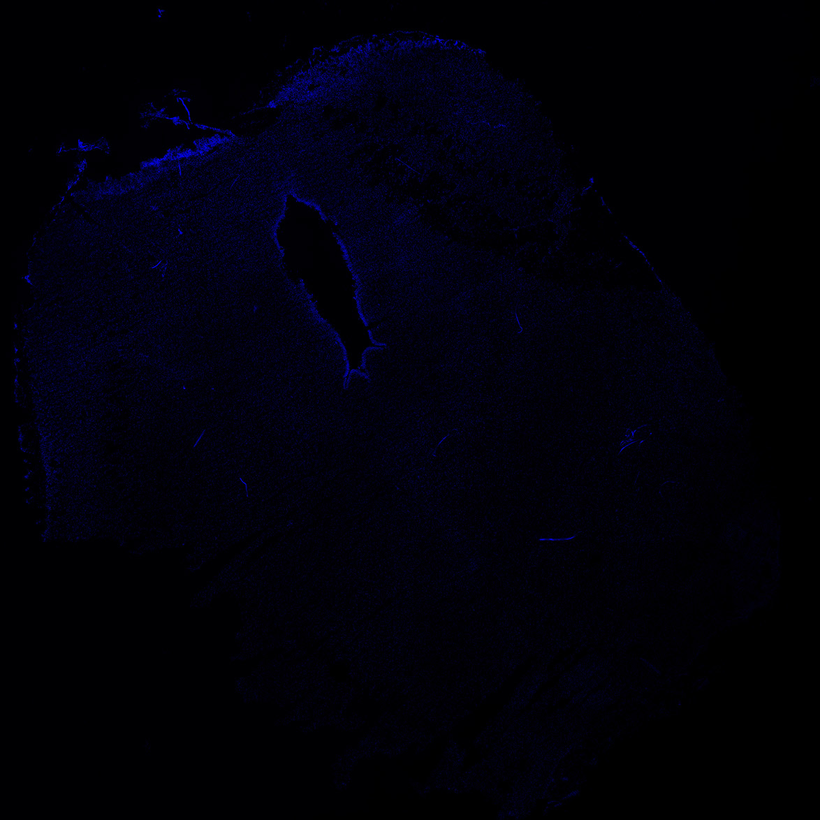 Human foetal midbrain